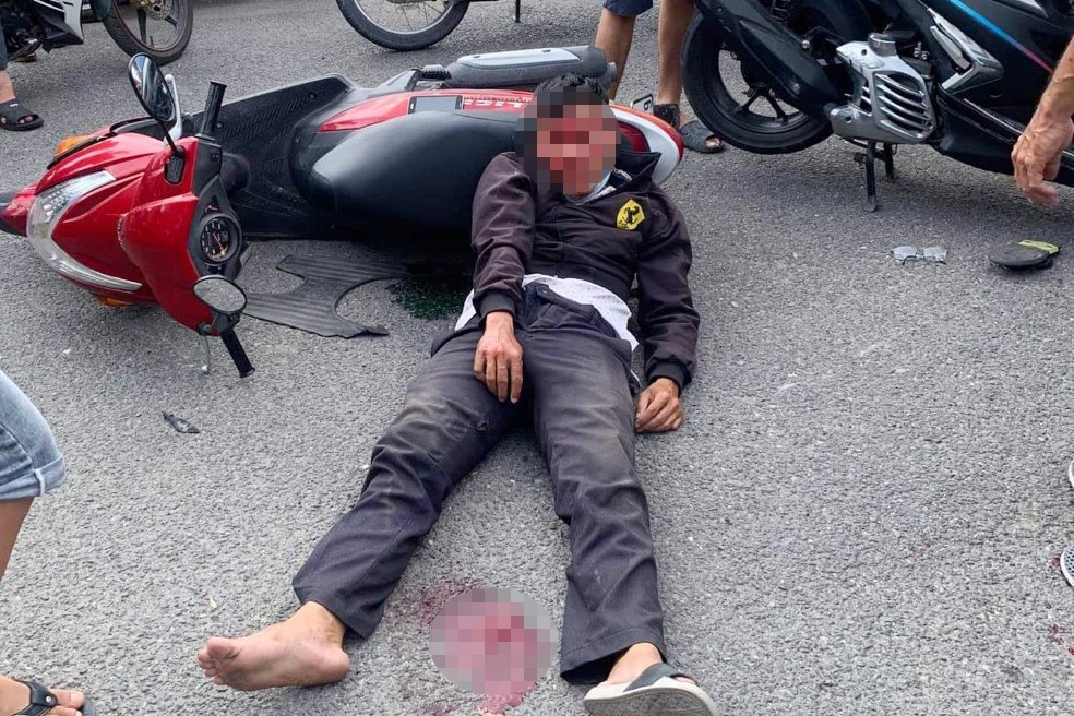 Thanh nien trom xe may roi bo chay gay tai nan hinh anh