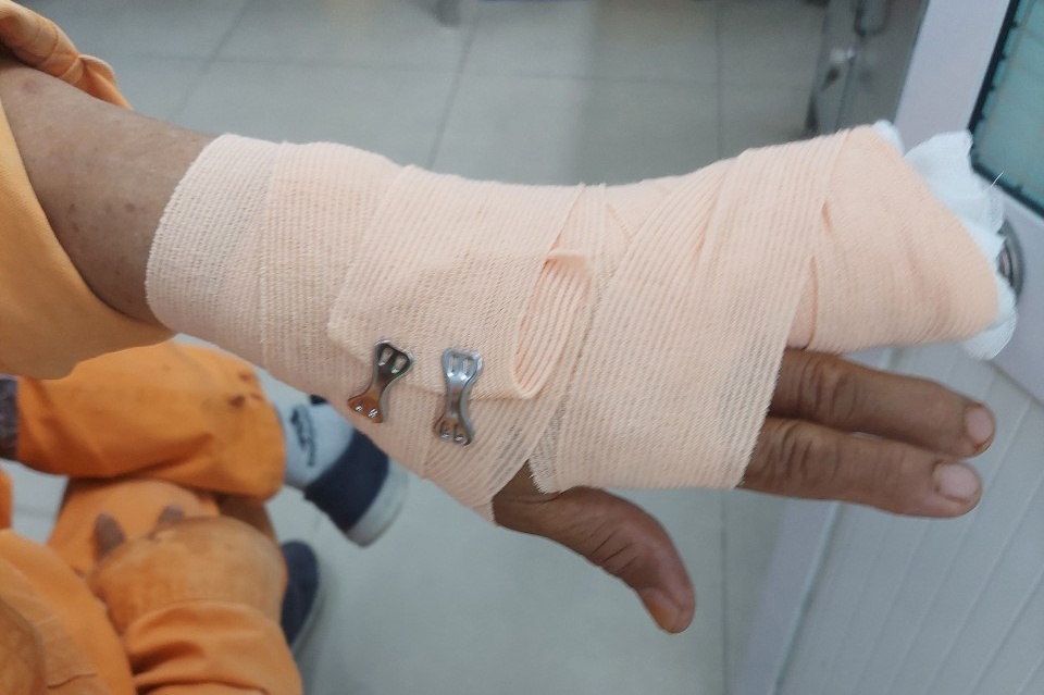 Nhac dong tien dien, nhan vien bi hanh hung dut gan ban tay hinh anh