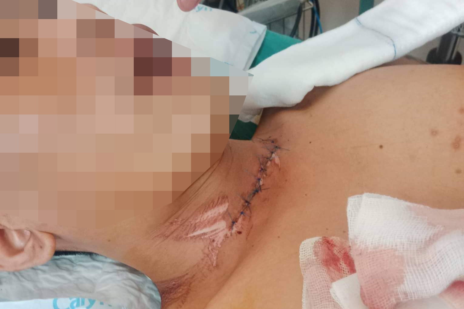 Nam thanh nien o TP.HCM nghi bi day dieu cua co hinh anh