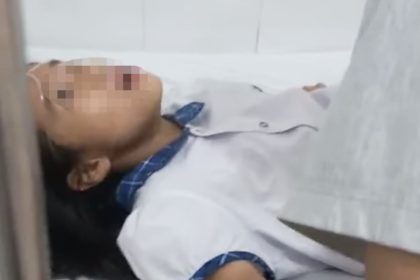 Hai hoc sinh lop 6 len con co giat khi an keo nguoi la cho hinh anh