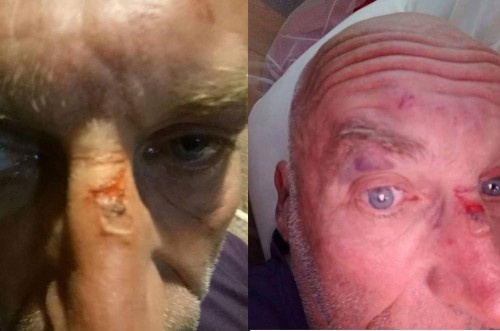 Vu xo xat o Sa Pa: Nguoi dan ong nuoc ngoai nhan sai hinh anh