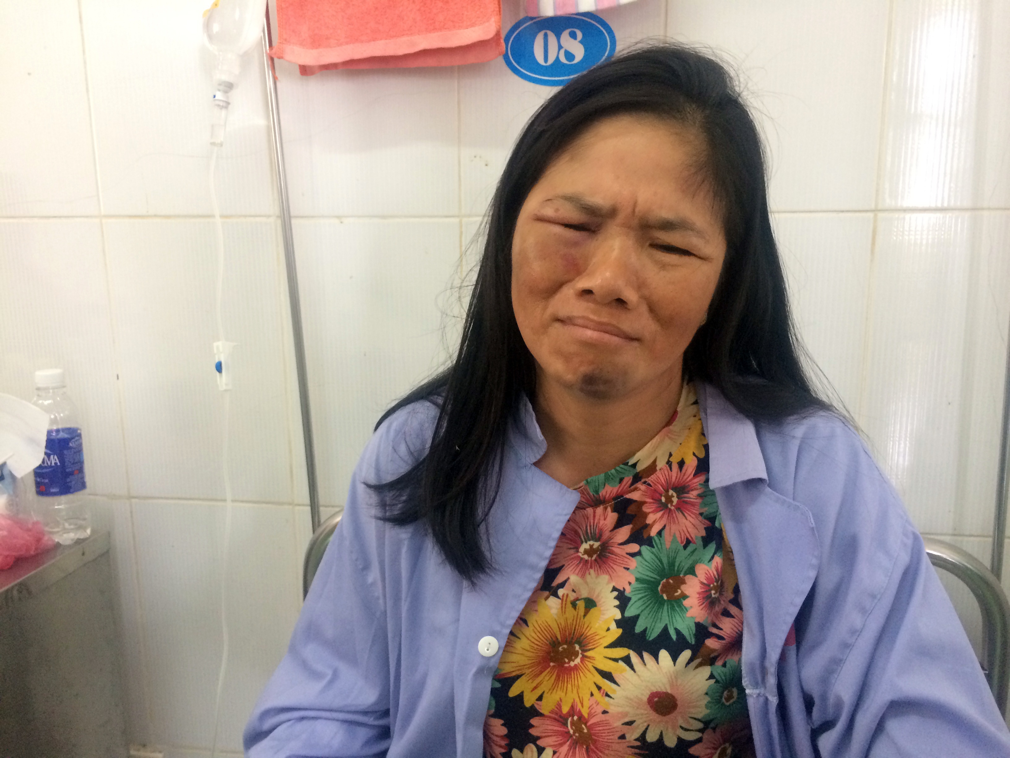 Nguoi ban tam nghi bat coc tre bi danh: Toi van xin nhung ho khong tha hinh anh