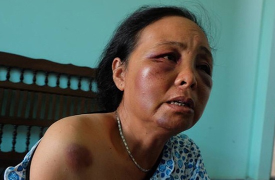 2 phu nu ban tam quyet lam ro dung sai sau vu bi danh nhap vien hinh anh