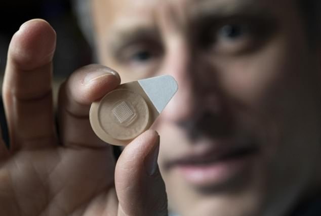 Tranh thai bang mieng dan su dung cong nghe vi kim hinh anh