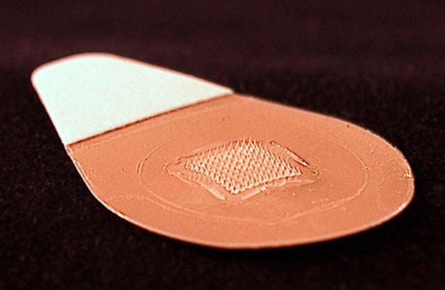 mieng dan vi kim tranh thai anh 2