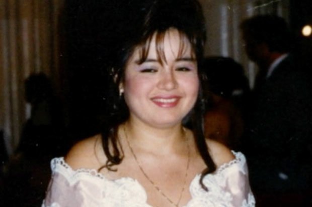 phẫu thuật hút mỡ nhưng lại bị sửa mũi ảnh 1 phau thuat hut mo nhung lai bi sua mui anh 1