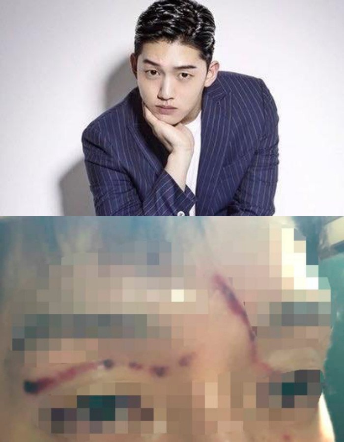 Goo Hara bi danh anh 5