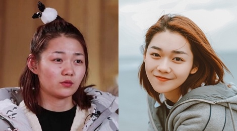 Mat moc san sui, nhieu mun cua nhom nhac nu hot nhat Trung Quoc hinh anh