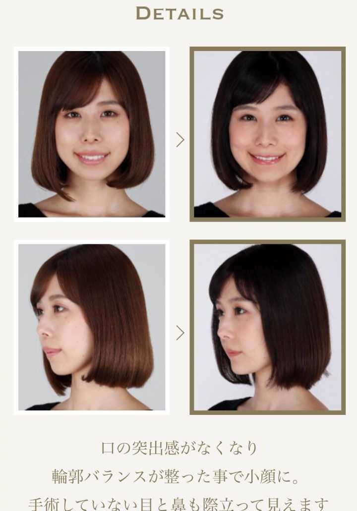 Arimura Kasumi anh 2