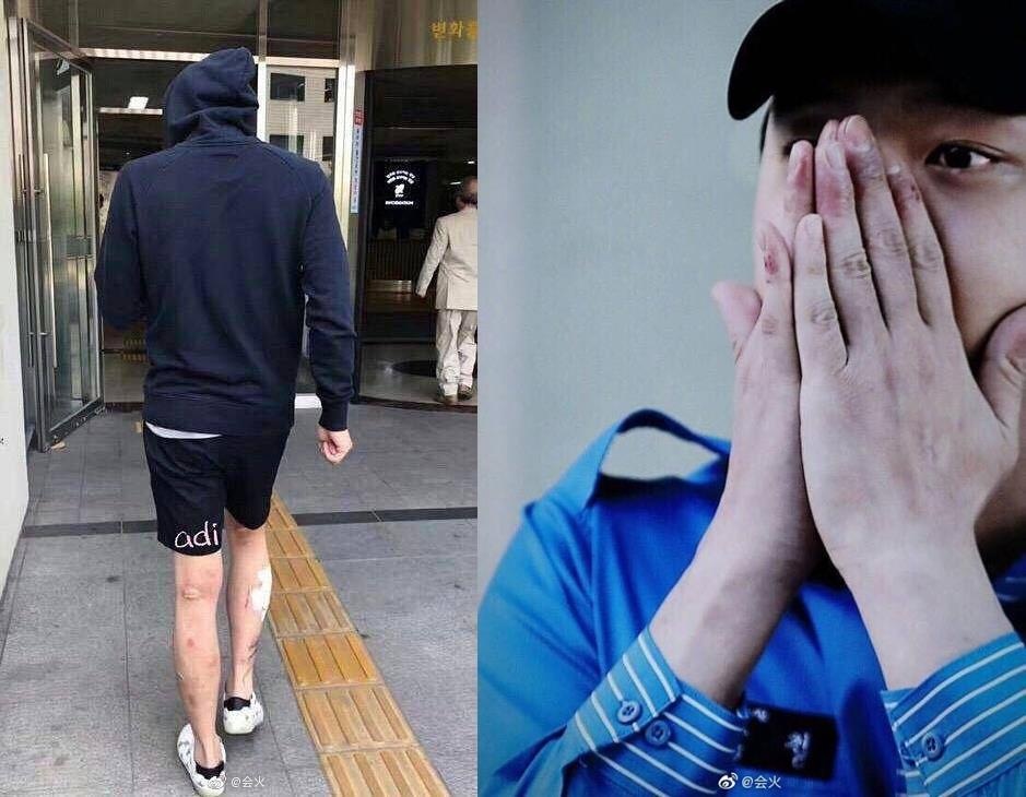 Park Yoochun hut ma tuy anh 2