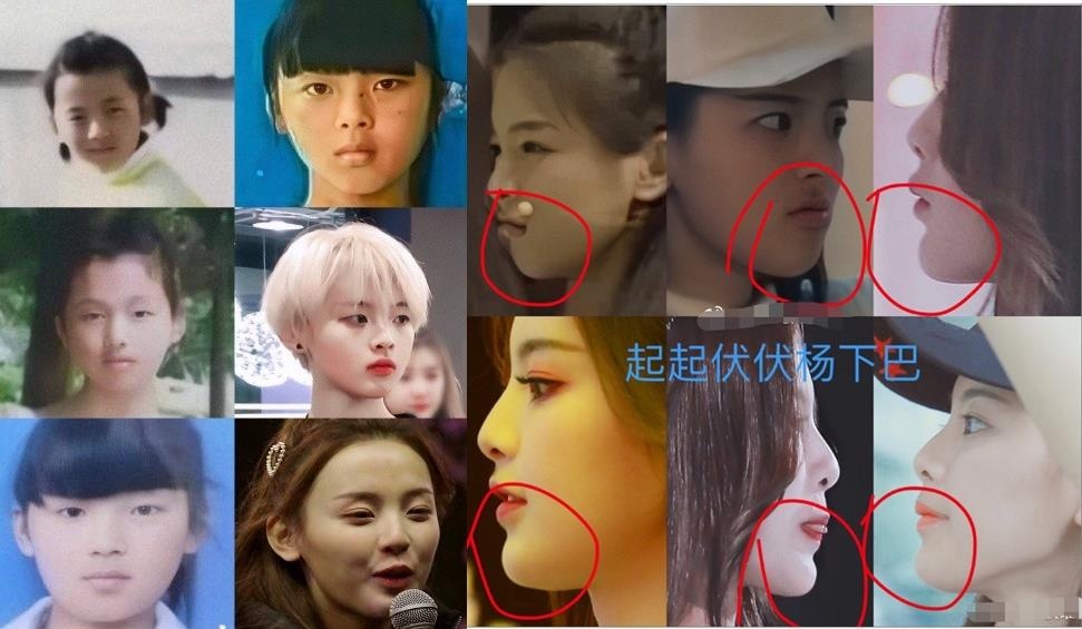 Duong Sieu Viet phau thuat tham my anh 1