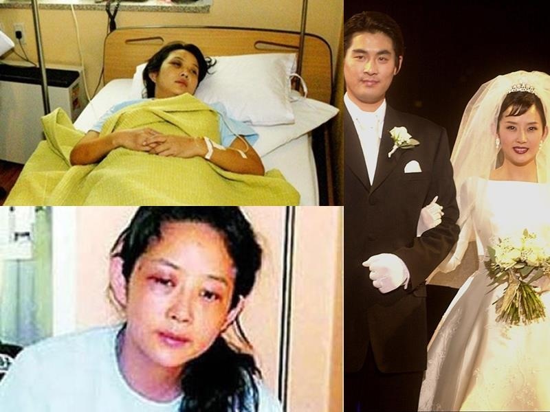 Choi Jin Sil bi bao hanh anh 4