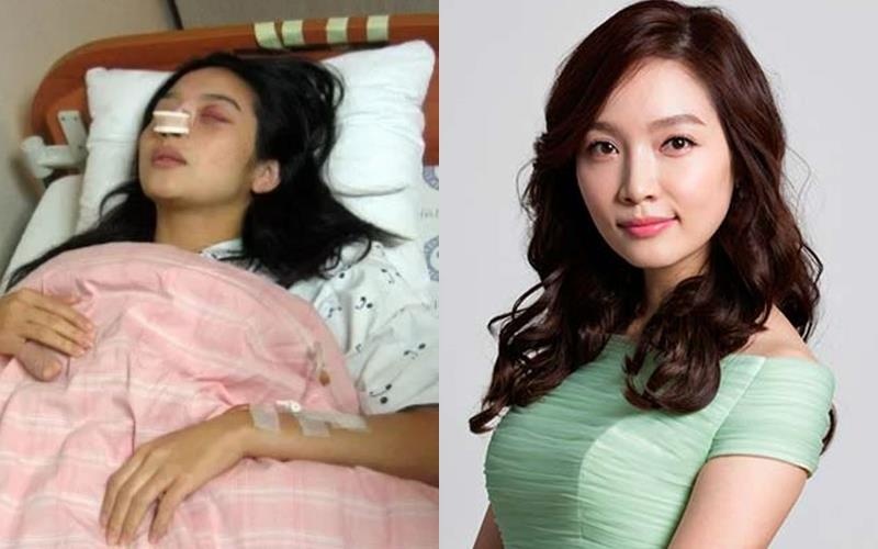 Choi Jin Sil bi bao hanh anh 3