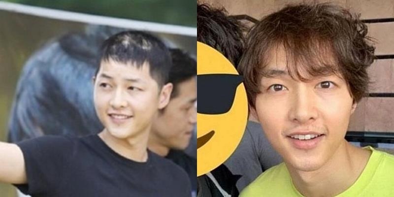 Song Joong Ki hoi dau anh 1