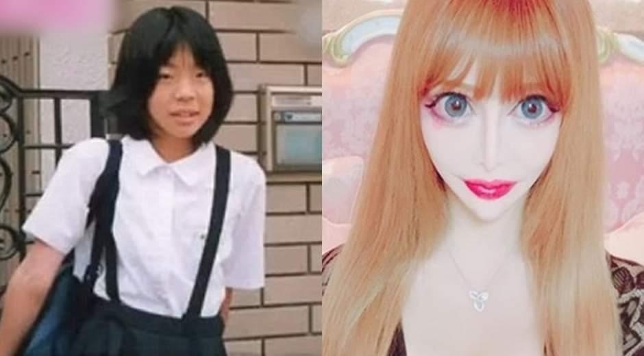 Nu nguoi mau bien thanh bup be song sau hang tram ca phau thuat hinh anh