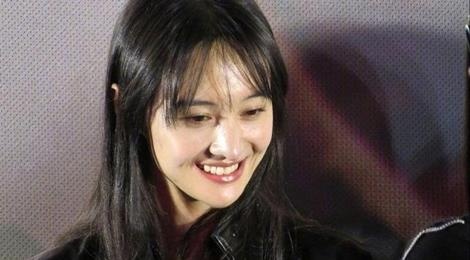 Trinh Sang lo chan gay, mui 'phu thuy' hinh anh