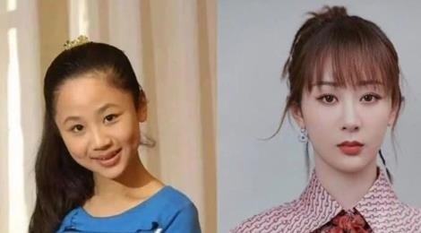 Duong Tu bi nghi phau thuat tham my hinh anh