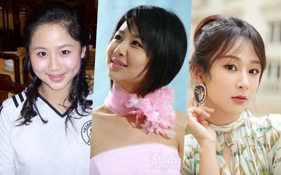 duong tu phau thuat tham my anh 2