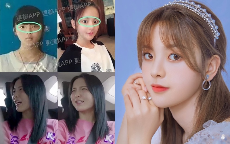 Cuc Tinh Y phau thuat tham my anh 8