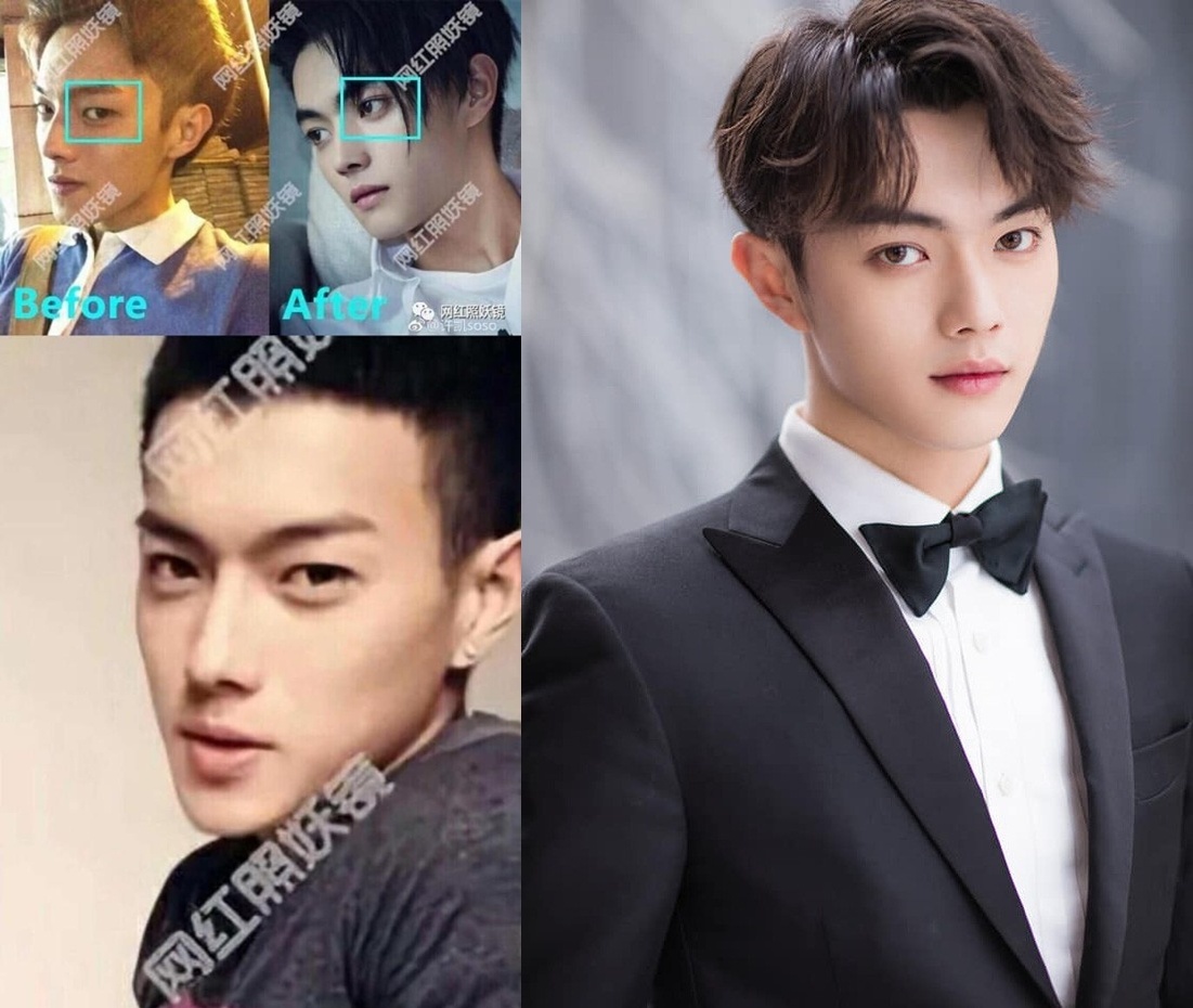 Cuc Tinh Y phau thuat tham my anh 4