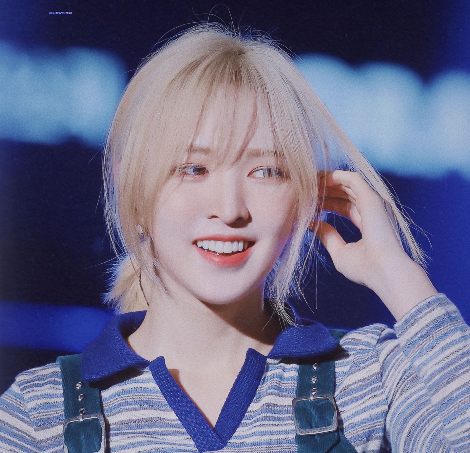 Wendy bi chan thuong anh 1