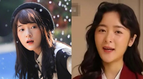 Con gai nuoi cua Chau Tinh Tri mat bien dang vi tham my hinh anh