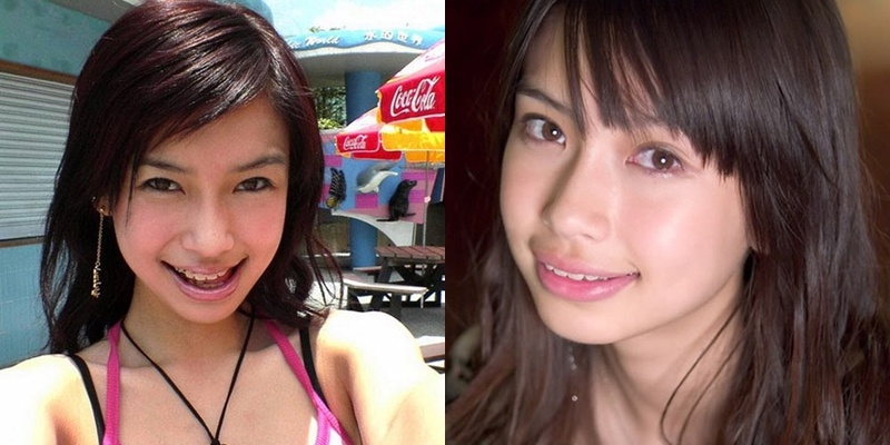 Angelababy phau thuat tham my anh 11