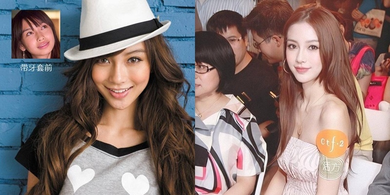 Angelababy phau thuat tham my anh 12