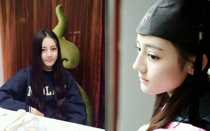 Angelababy phau thuat tham my anh 4