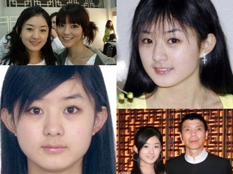 Angelababy phau thuat tham my anh 14