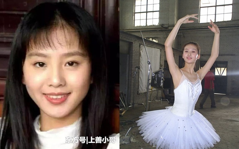 Angelababy phau thuat tham my anh 10