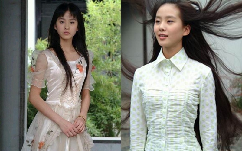 Angelababy phau thuat tham my anh 9