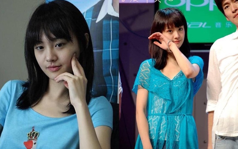 Angelababy phau thuat tham my anh 7