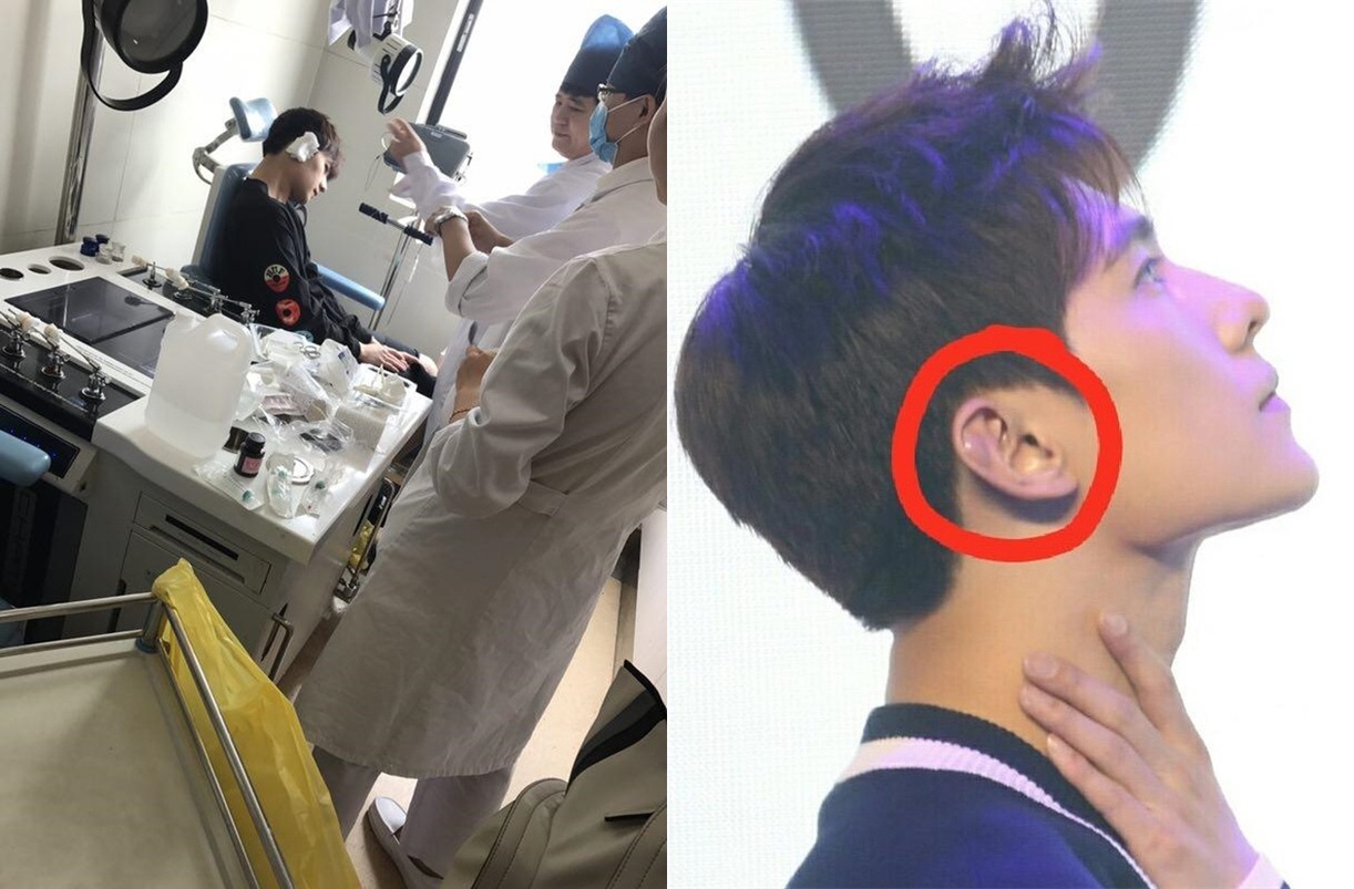 Trieu Le Dinh bi thuong anh 1