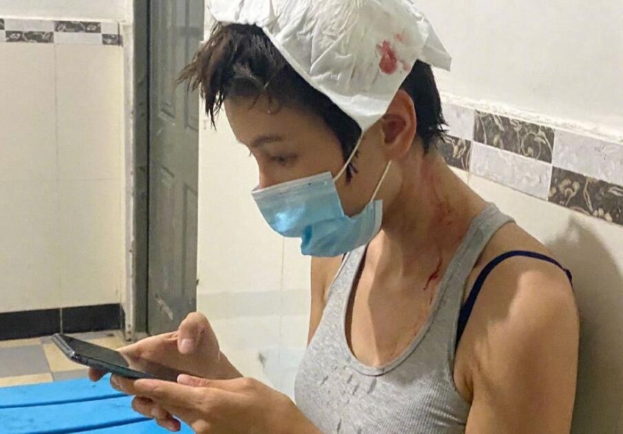 Truong Lam Tam bi thuong anh 2