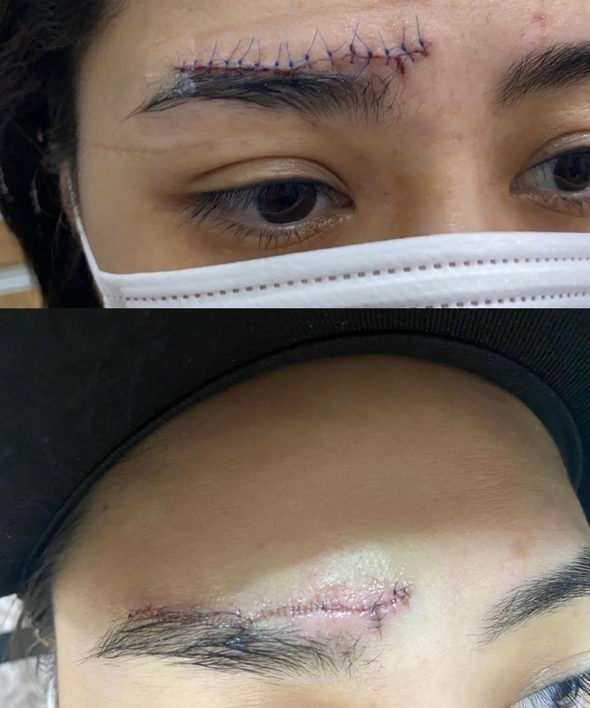 Chung Han Dong nga trong nha ve sinh anh 2