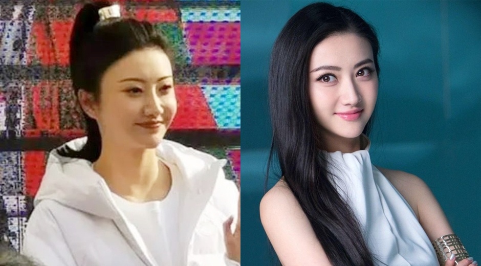 Canh Diem phau thuat tham my hong? hinh anh