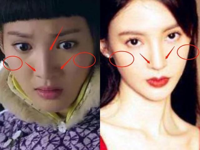 Kim Than phau thuat tham my anh 2