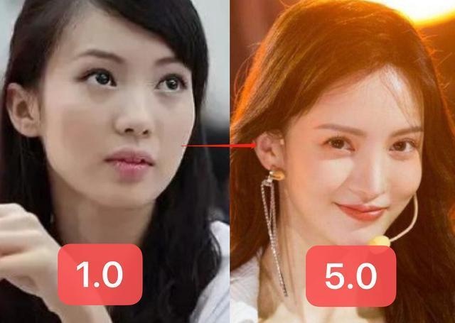 Kim Than phau thuat tham my anh 3