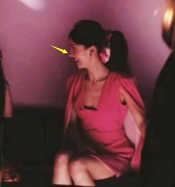 Kim Than phau thuat tham my anh 12