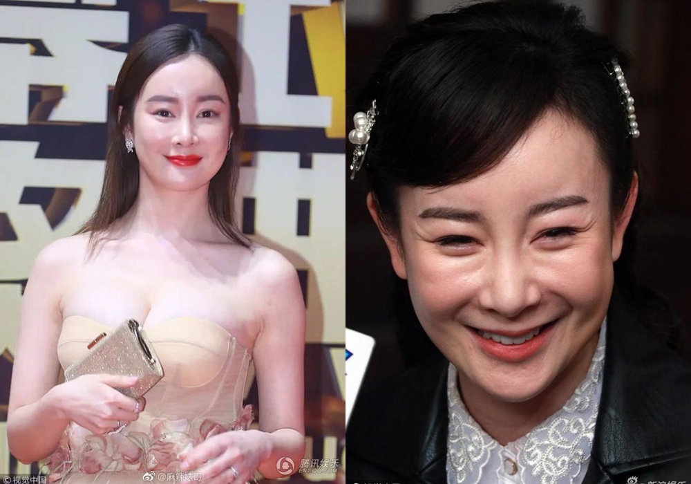 Bi kich cua nhung dien vien phau thuat tham my hong hinh anh