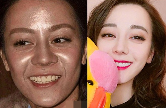 Angelababy chua phau thuat anh 6