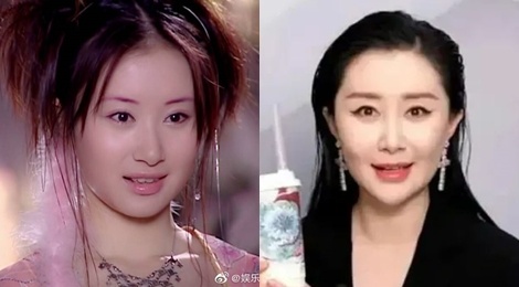 My nhan 'Thien long bat bo' gay tiec nuoi vi guong mat thay doi hinh anh