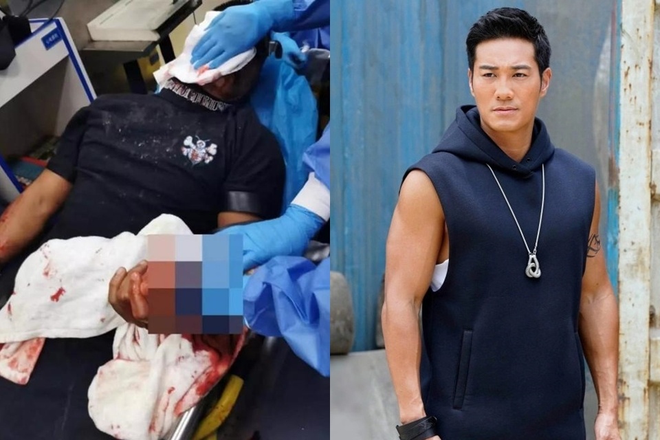 Suc khoe dien vien TVB bi dam, phai khau 100 mui hinh anh