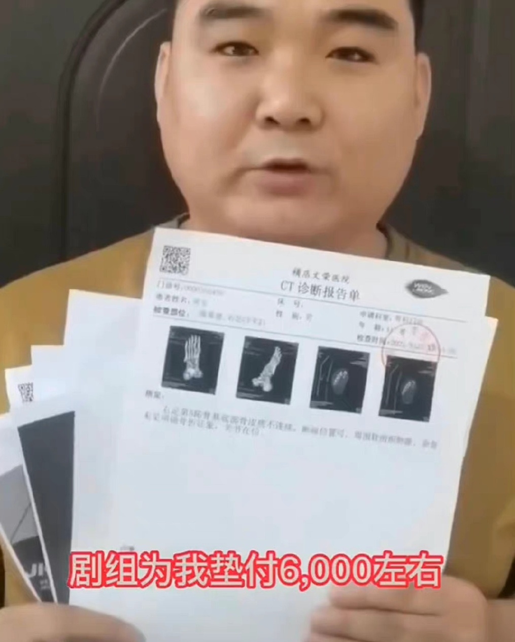 Lưu Thi Thi ảnh 2 Luu Thi Thi anh 2