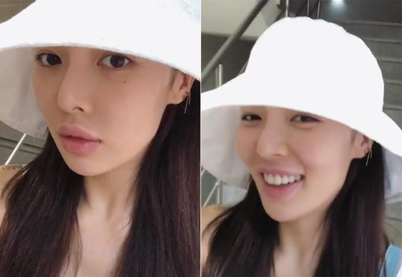 HyunA lo moi teu sau khi phu nhan tiem filter anh 1