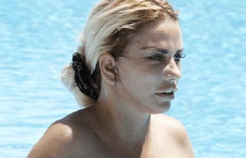 Katie Price lo hong tai sau phau thuat tham my hinh anh