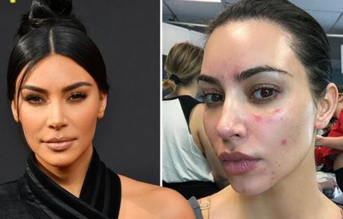 Kim Kardashian dang anh mat moc bi vay nen hinh anh