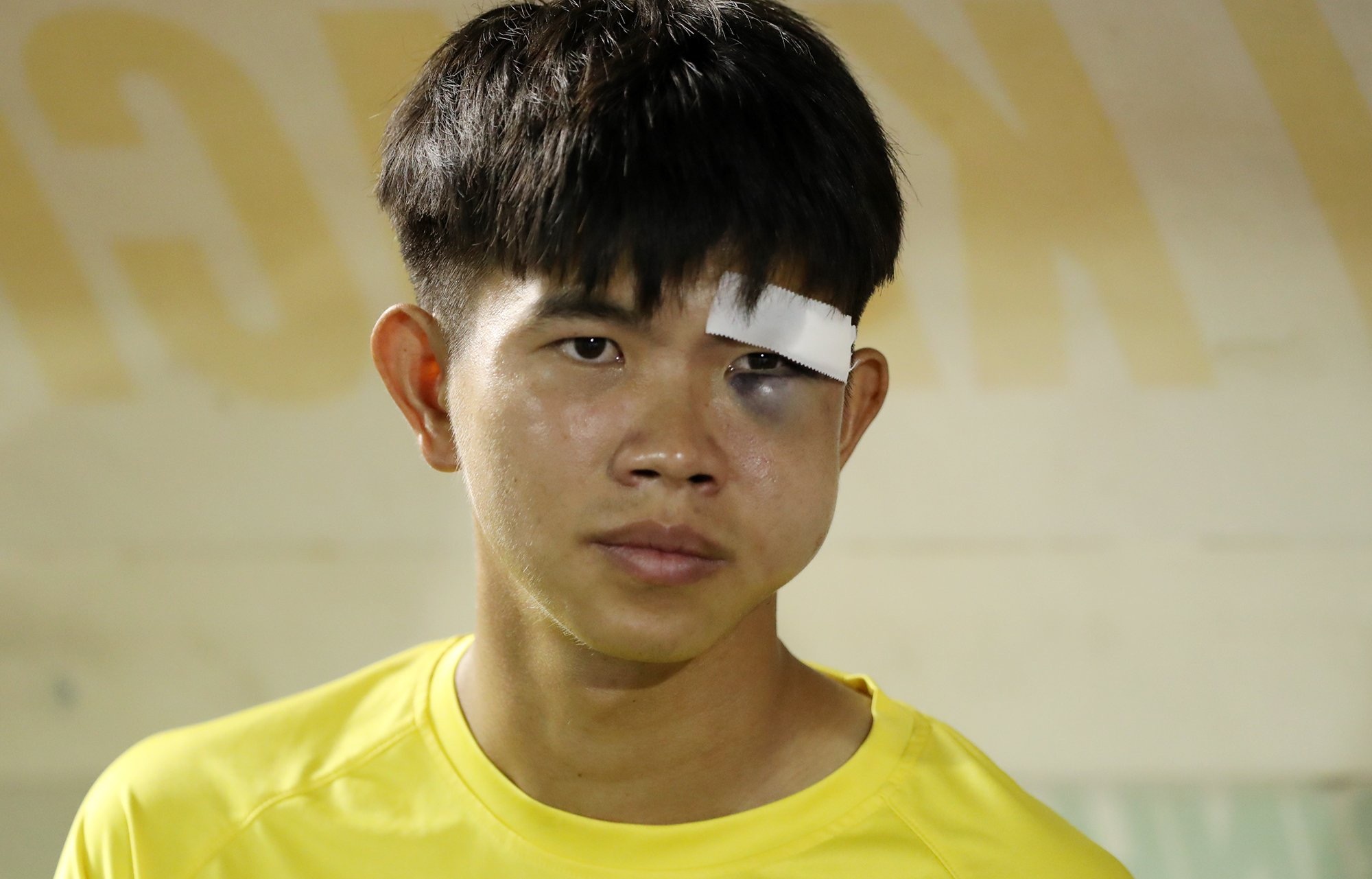 Cau thu bi gay xuong go ma tai giai hang Nhat hinh anh