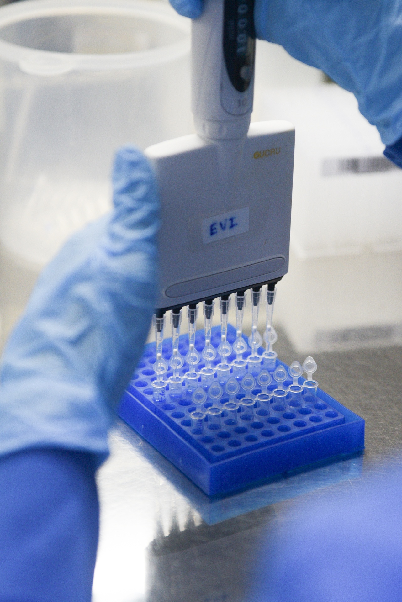 xet nghiem Covid-19 anh 14